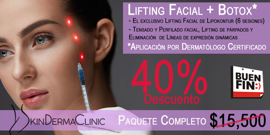 El mejor Lifting facial sin cirugía México DF | LIPOKONTUR RADIOFRECUENCIA DVTP rejuvenecimiento facial dermatologo buen fin